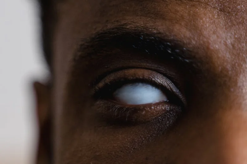 눈썹 탈색 시 실명 위험 있다는 말, 사실일까?