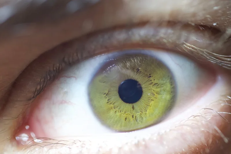 눈썹 탈색 약이 눈에 들어갔을 때 응급처치