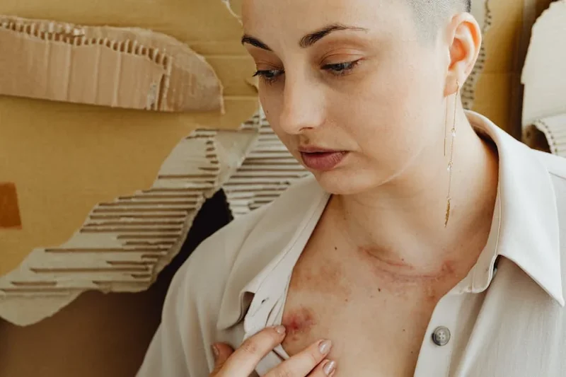 눈썹 탈색 후 민감 피부 회복 케어