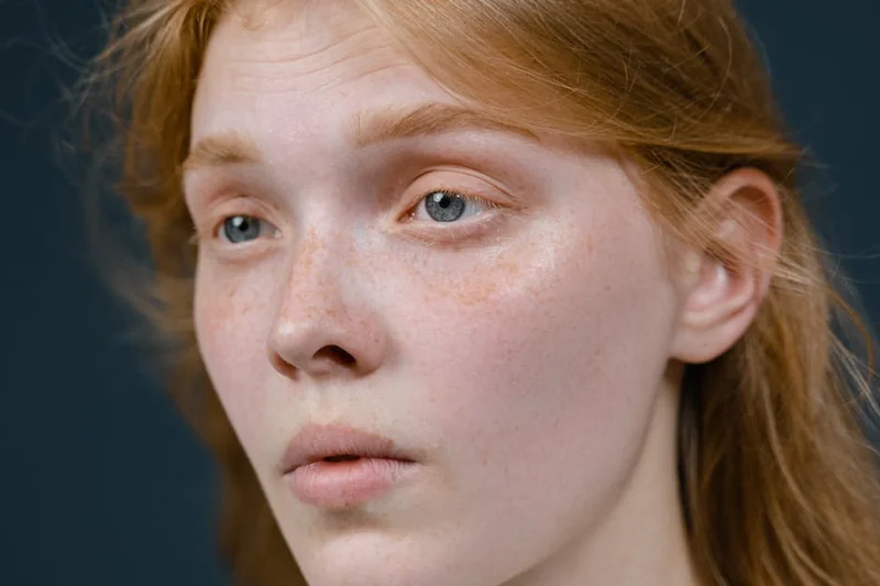 눈썹 탈색 후 피부 벗겨짐 치료법