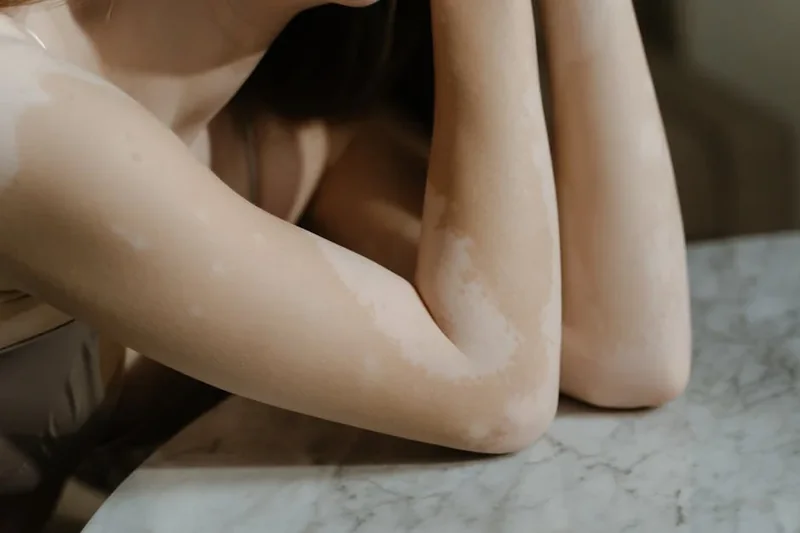 눈썹 탈색 후 피부 트러블 막는 습관