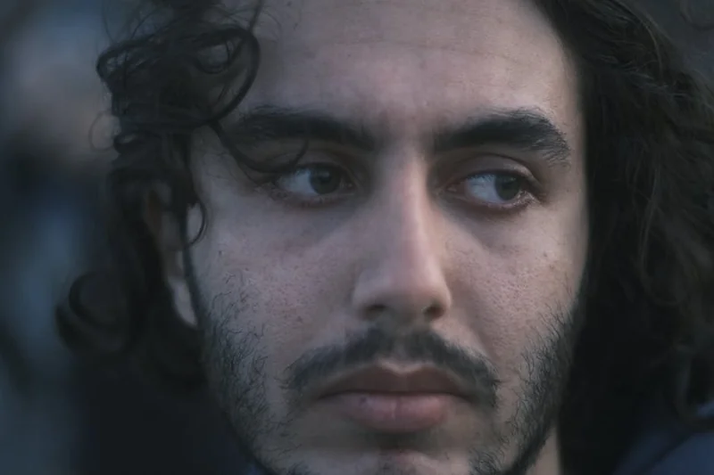 턱끝필러 시술 후 눈썹 탈색해도 괜찮나요?